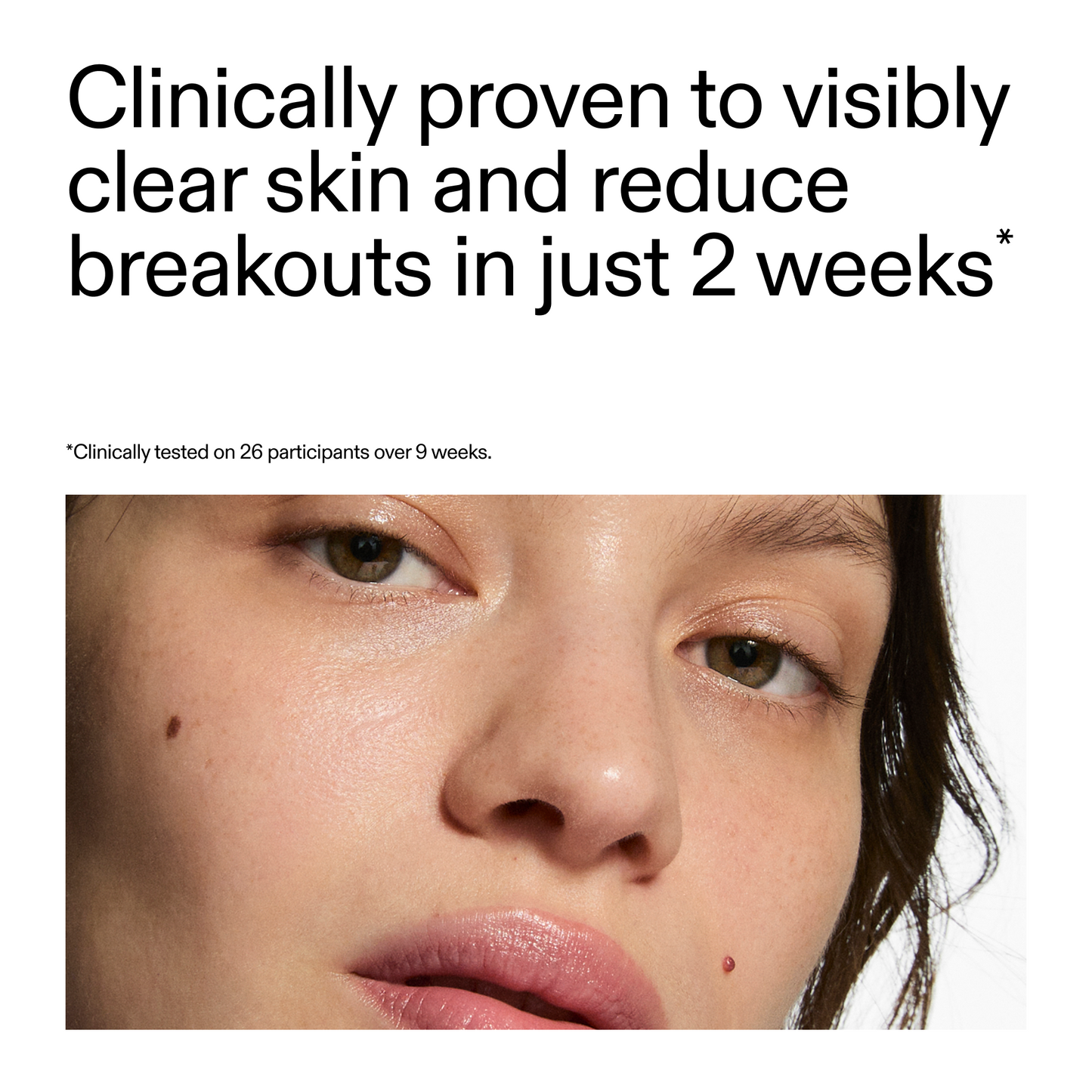 360-acne-clearing-serum-x8 360_Serum_Key_Claim.png