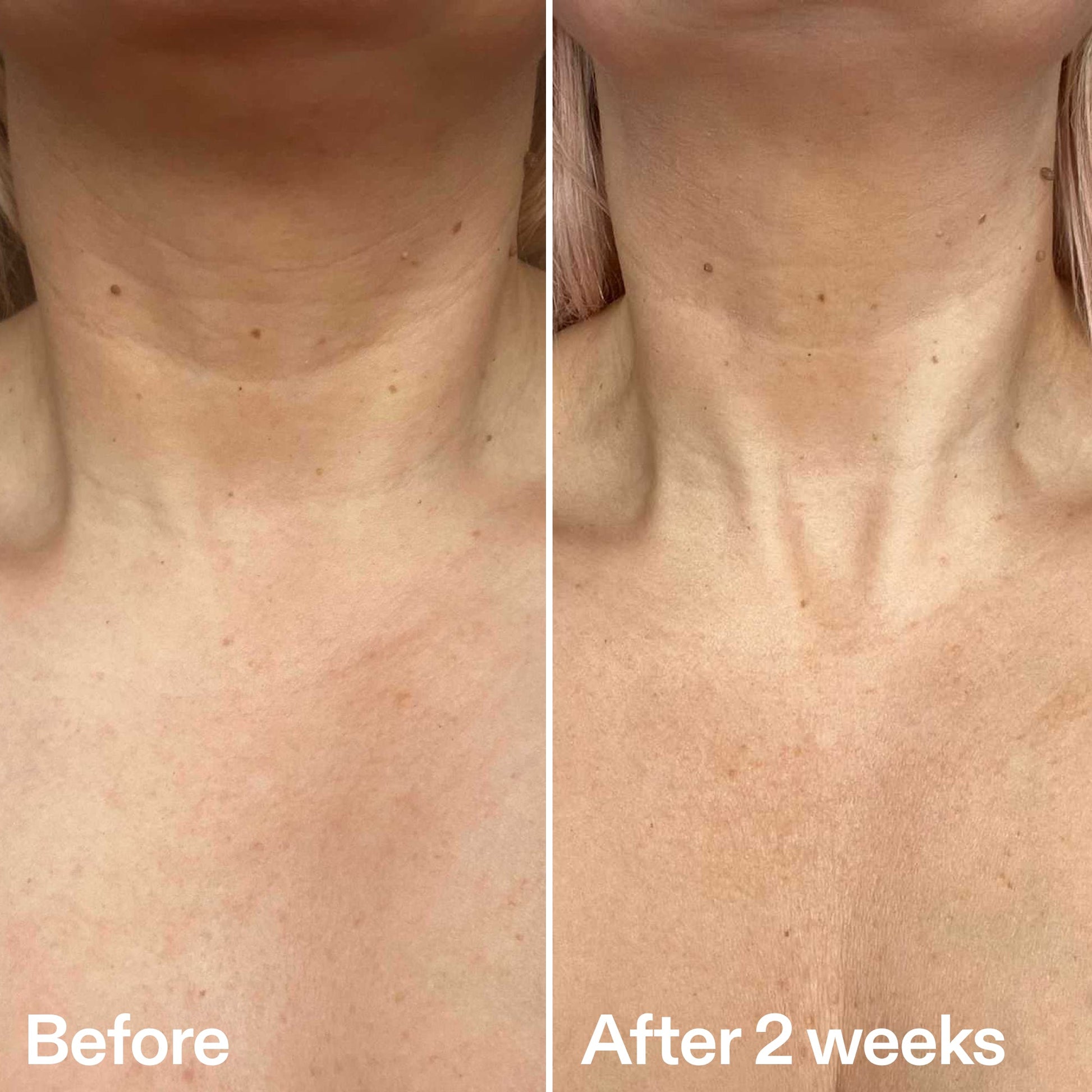 bio-active-neck-lift-stick-g8 B_A_2.jpg