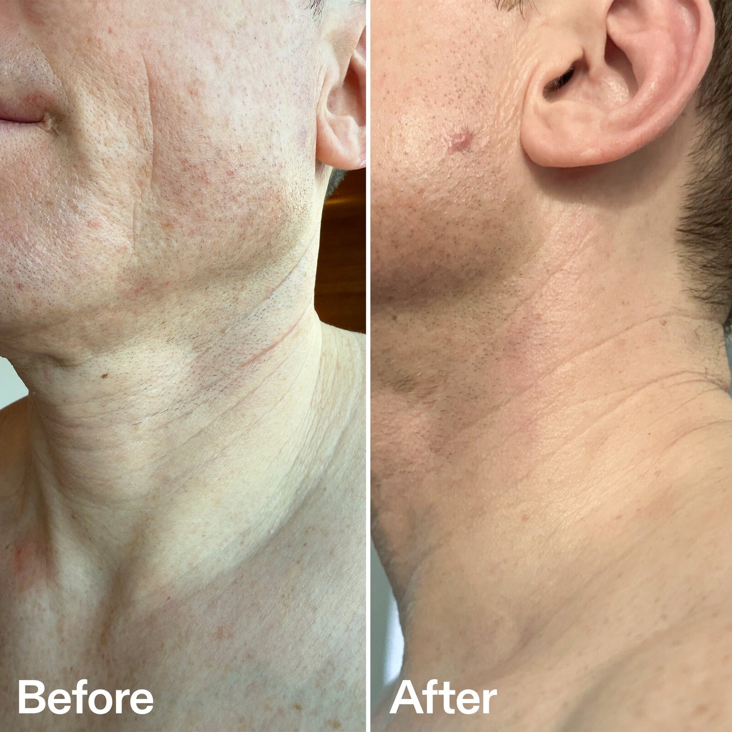bio-active-neck-lift-stick-g8 B_A_afa2743e-b8e2-4504-92f4-e281cb6cf759.jpg