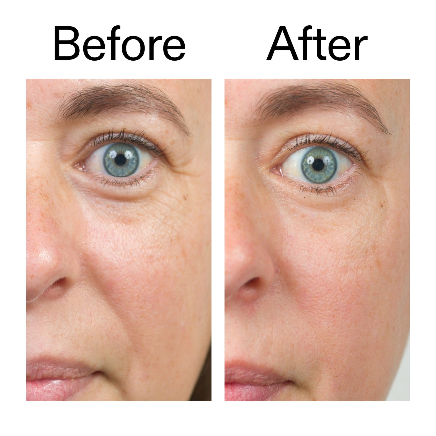 bio-active-ceramide-moisturizer-d7 Bio-Active_Before_After_2000x2000_566e5a9e-135e-417a-8242-b44e5fa35463.jpg