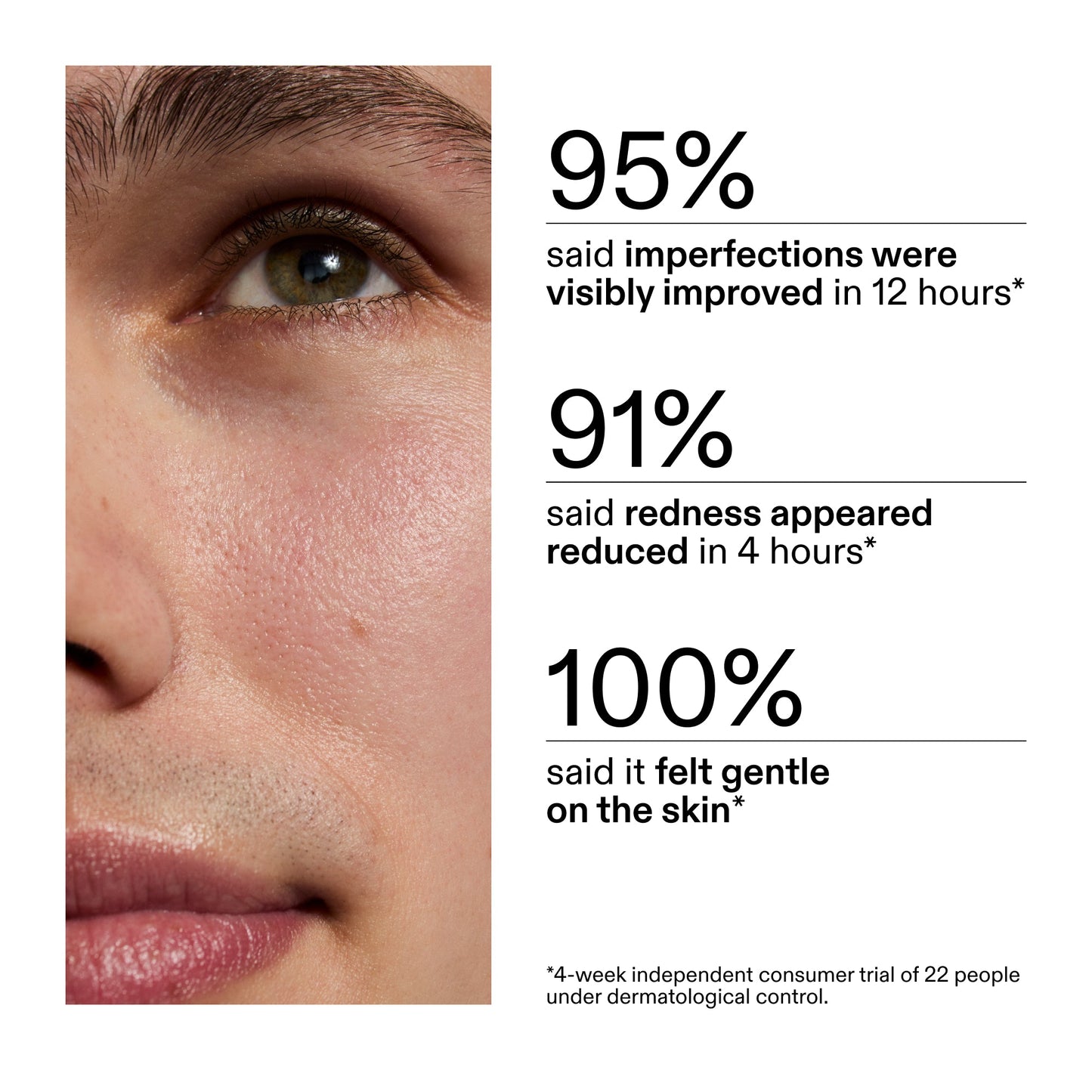 succinic-acid-acne-treatment-g2 CA_Succinic_Acid_Treatment_key_Claims_2000x2000_db91b0f1-7f29-4bfe-bb16-63a47f500960.jpg