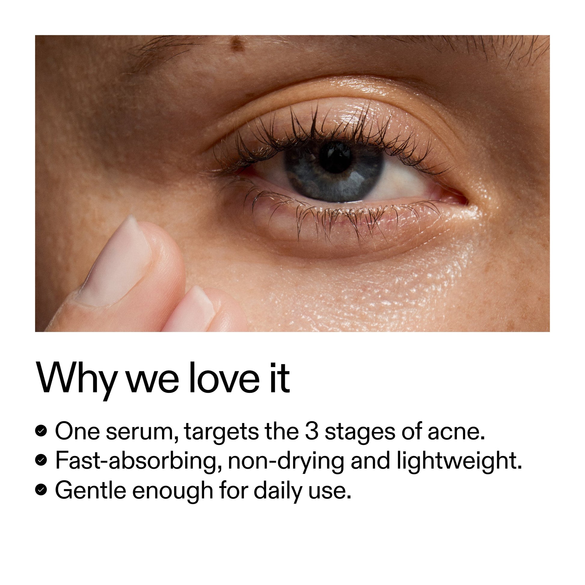 360-acne-clearing-serum-x8 Dioic_Whyweloveit_2000x2000_175aafd3-0cbe-403a-b317-a8362881bfe2.jpg