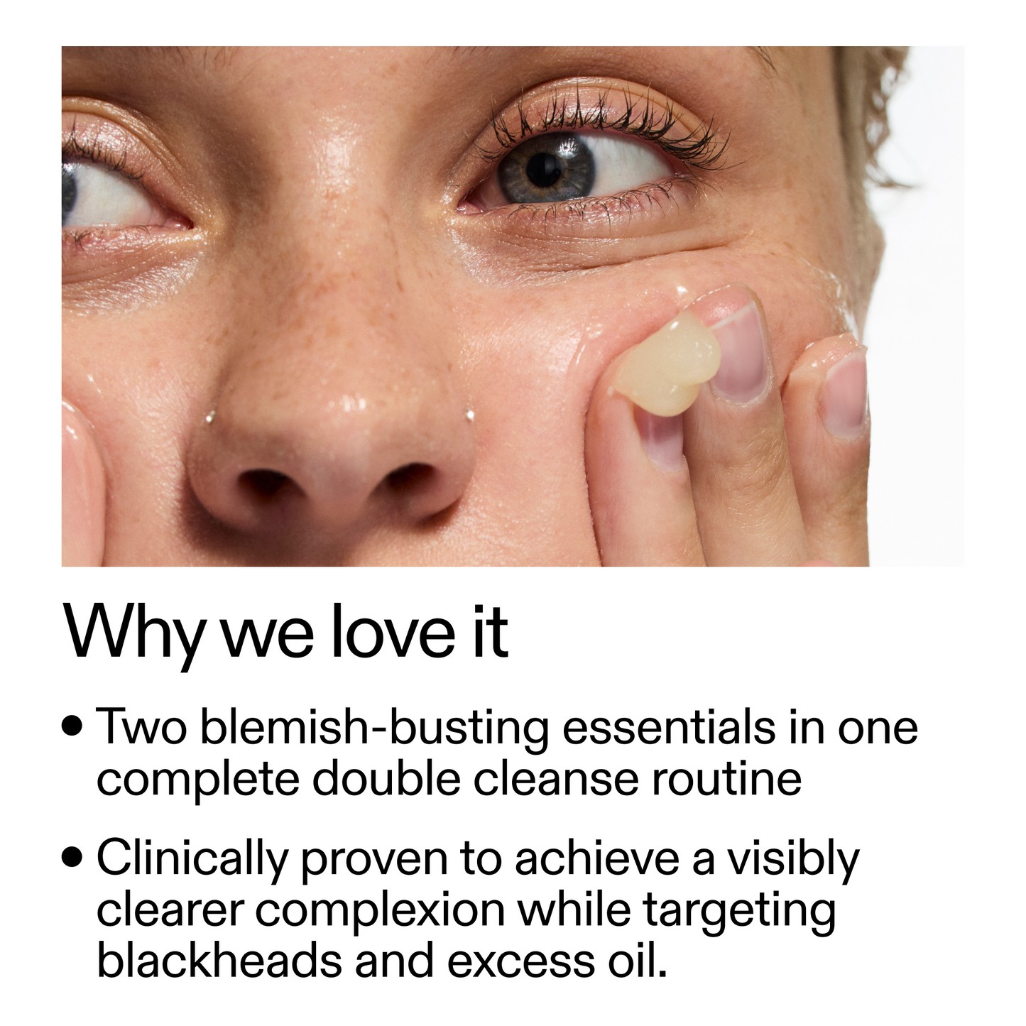 acne-double-cleanse-duo-o8 Double_Cleanse_Duo_for_Breakouts_Why_We_2000x2000_f242cb12-bb5c-487c-b203-071ccb406ec5.png