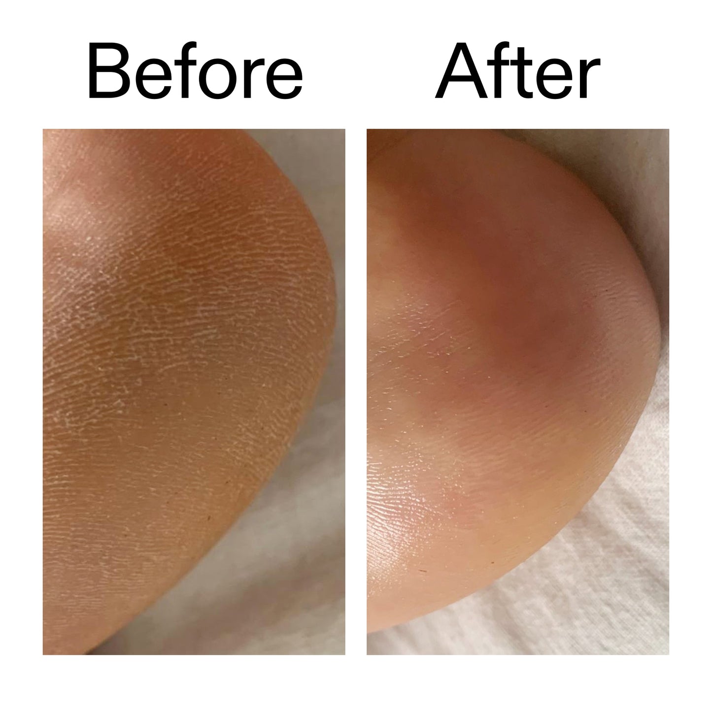 glycolic-acid-exfoliating-body-stick-duo-v5 Glycolic_Acid_Exfoliating_Body_Stick_Before_After_V1_2000x2000_a3043625-9400-429a-a7fb-d6dbd220f722.jpg