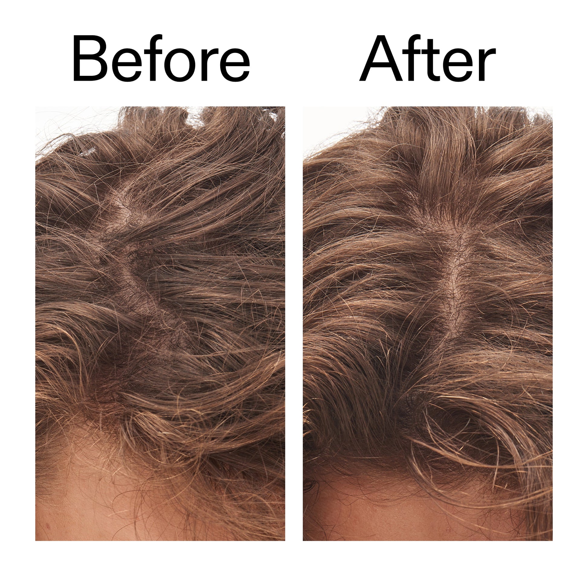 glycolic-acid-exfoliating-scalp-scrub-o1 Glycolic_Acid_Exfoliating_Scalp_Scrub_Before_After_2000x2000_b8561c87-05a1-4caa-80f7-1b6b33d750f7.jpg