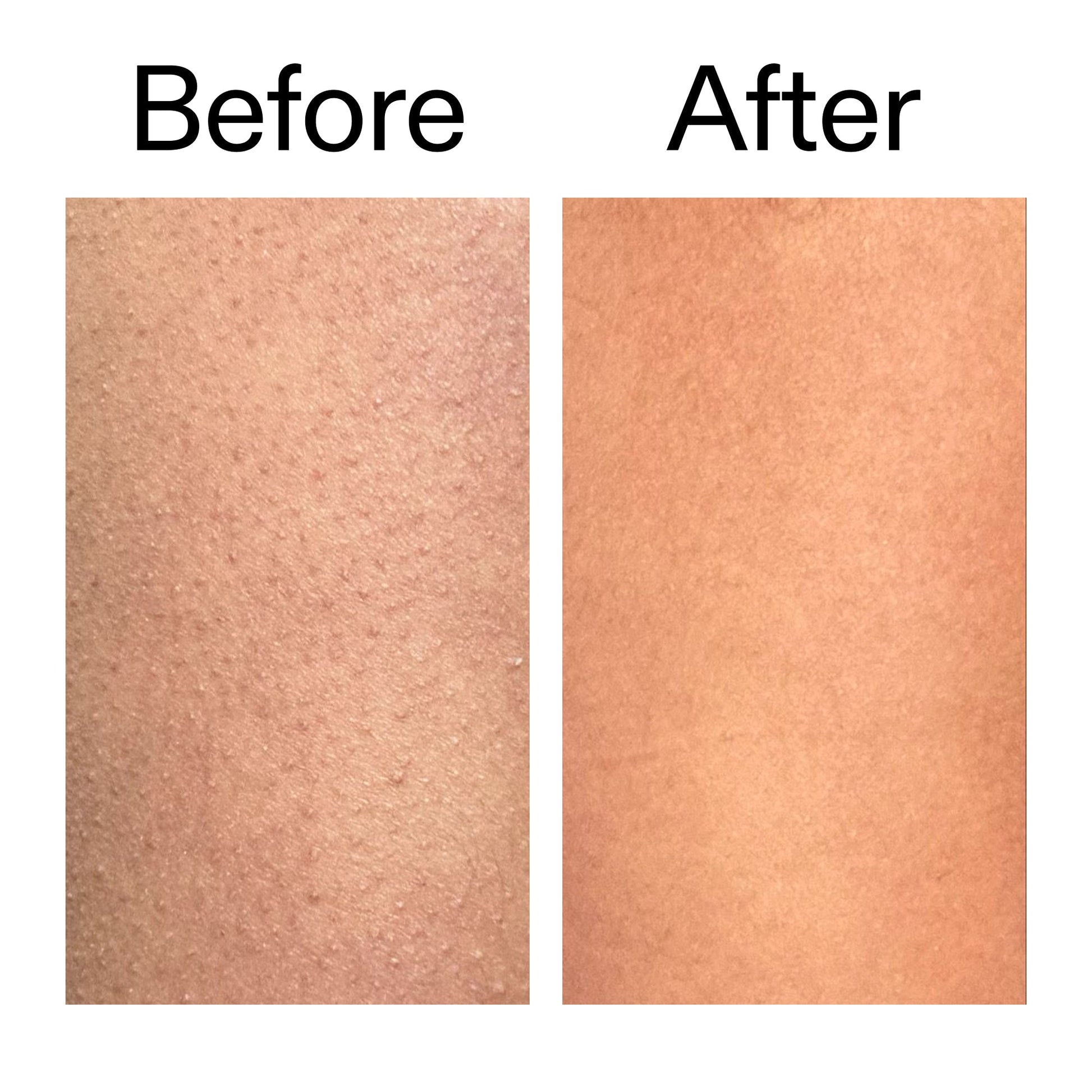 glycolic-acid-exfoliating-body-stick-duo-v5 Glycolic_Body_Stick_B_A_2000x2000_6e6e6b4d-5bd7-43c0-aeed-4d66788e8995.jpg