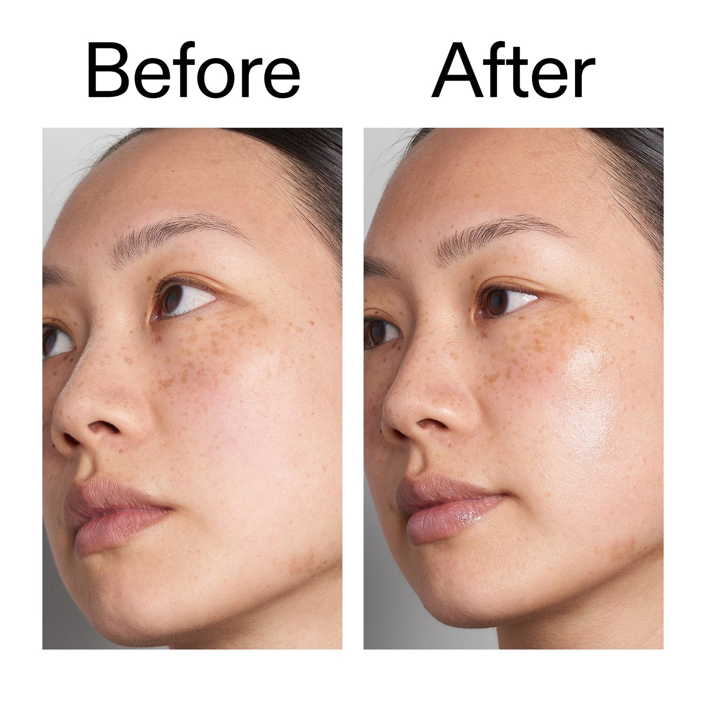 supersize-hyaluronic-acid-serum-100ml-u9 Hyaluronic_Acid_Before_After_2000x2000_d7983956-8aa2-4ea3-8255-c63e8d4f892e.jpg