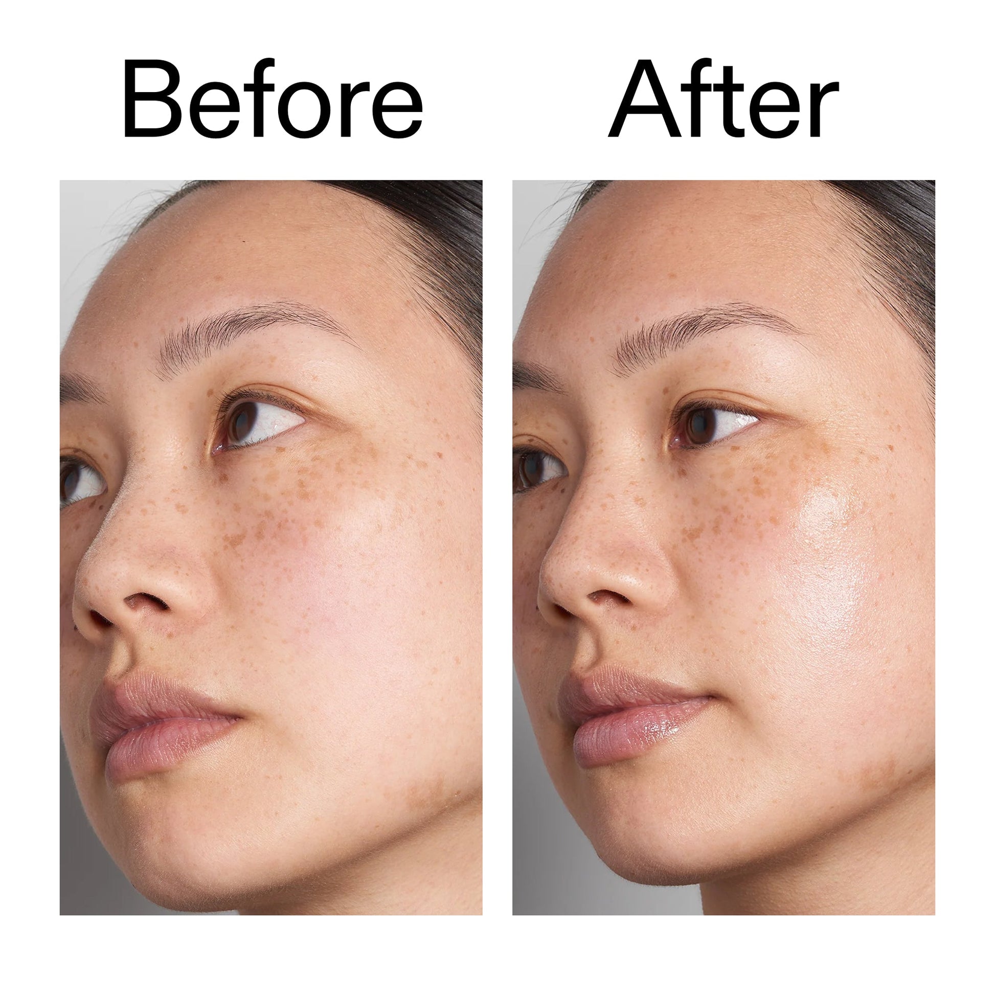 supersize-hyaluronic-acid-serum-100ml-u9 Hyaluronic_Acid_Before_After_2000x2000_d7983956-8aa2-4ea3-8255-c63e8d4f892e.jpg
