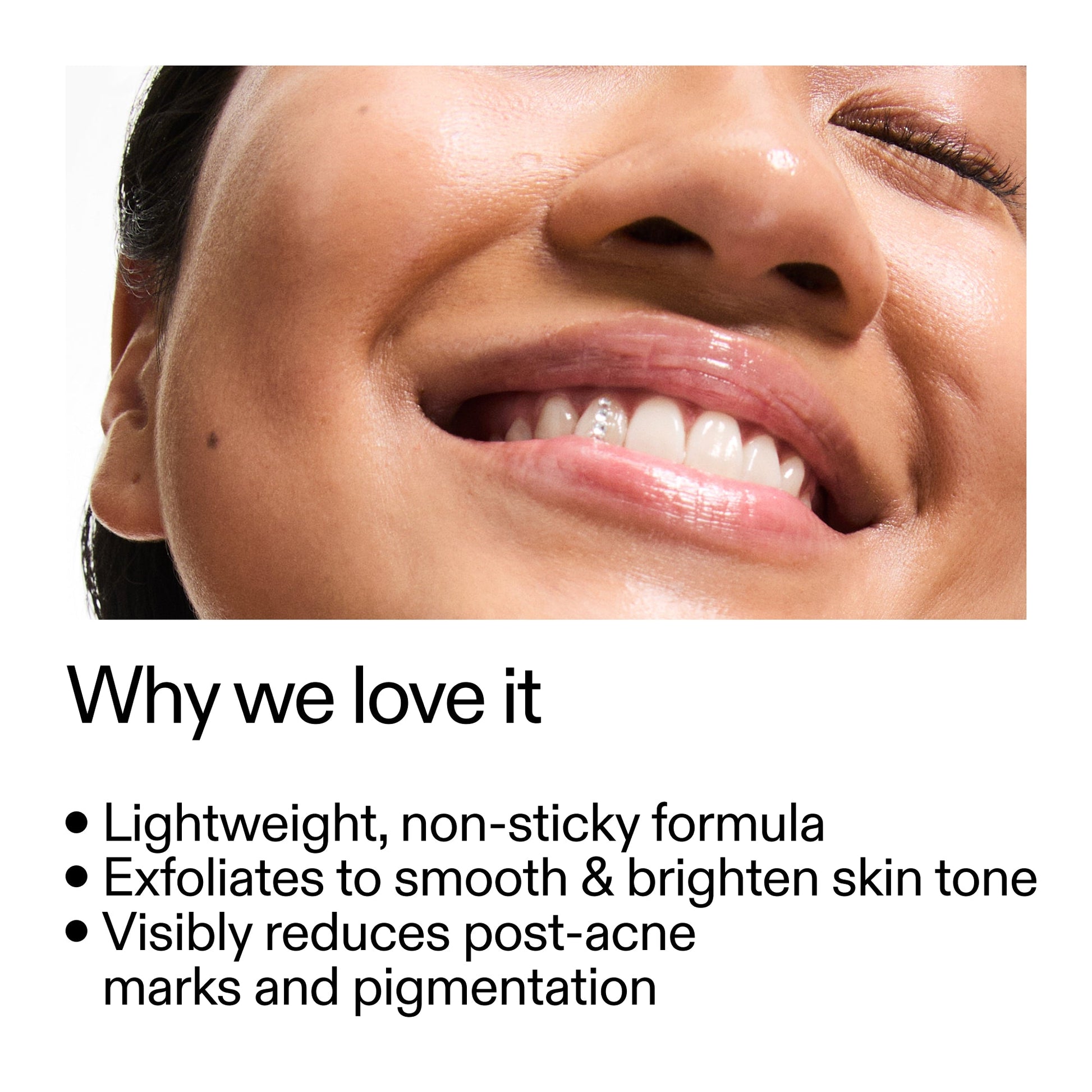 mandelic-acid-treatment-x9 Mandelic_Acid_Treatment_Why_we_love_it_2000x2000_6dfe29a9-2a79-464f-a5e8-e5ac37d93388.jpg