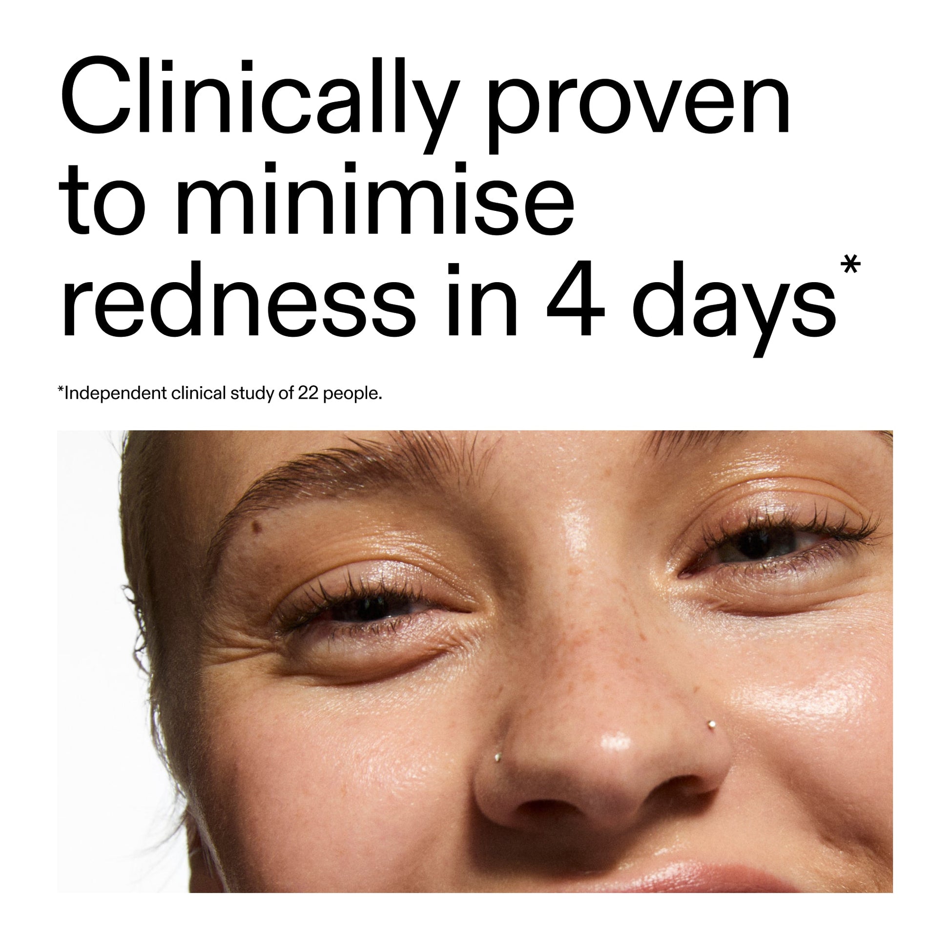 10-azelaic-acid-serum-for-redness-relief-i3 Oat_Cleansing_Balm_Claim_2000x2000_52a841dc-353c-4f2c-8646-3aadb604507d.jpg
