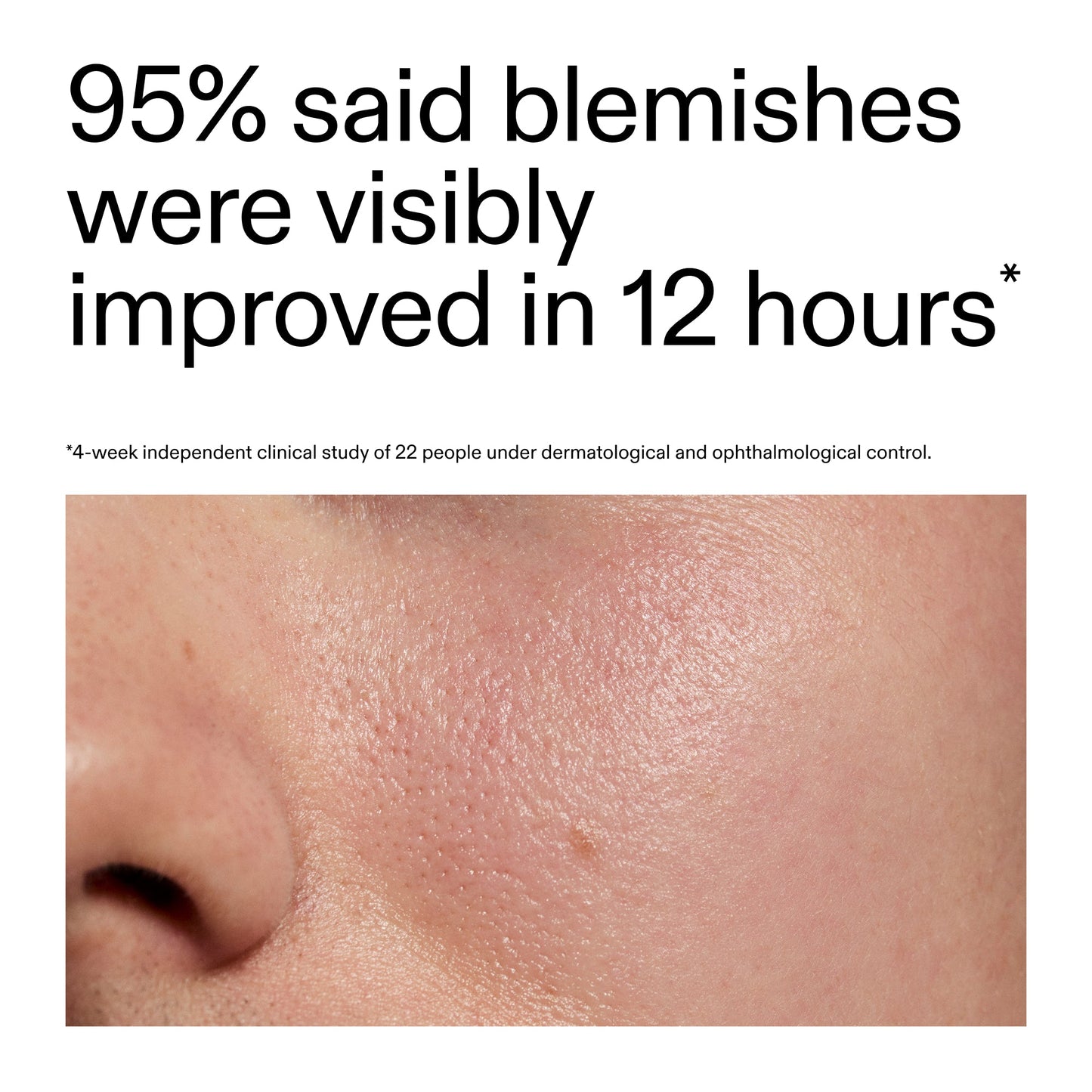 succinic-acid-acne-treatment-g2 Oat_Cleansing_Balm_Claim_2000x2000_ac6ce553-25db-41b2-a981-faae1ac4b8c0.jpg