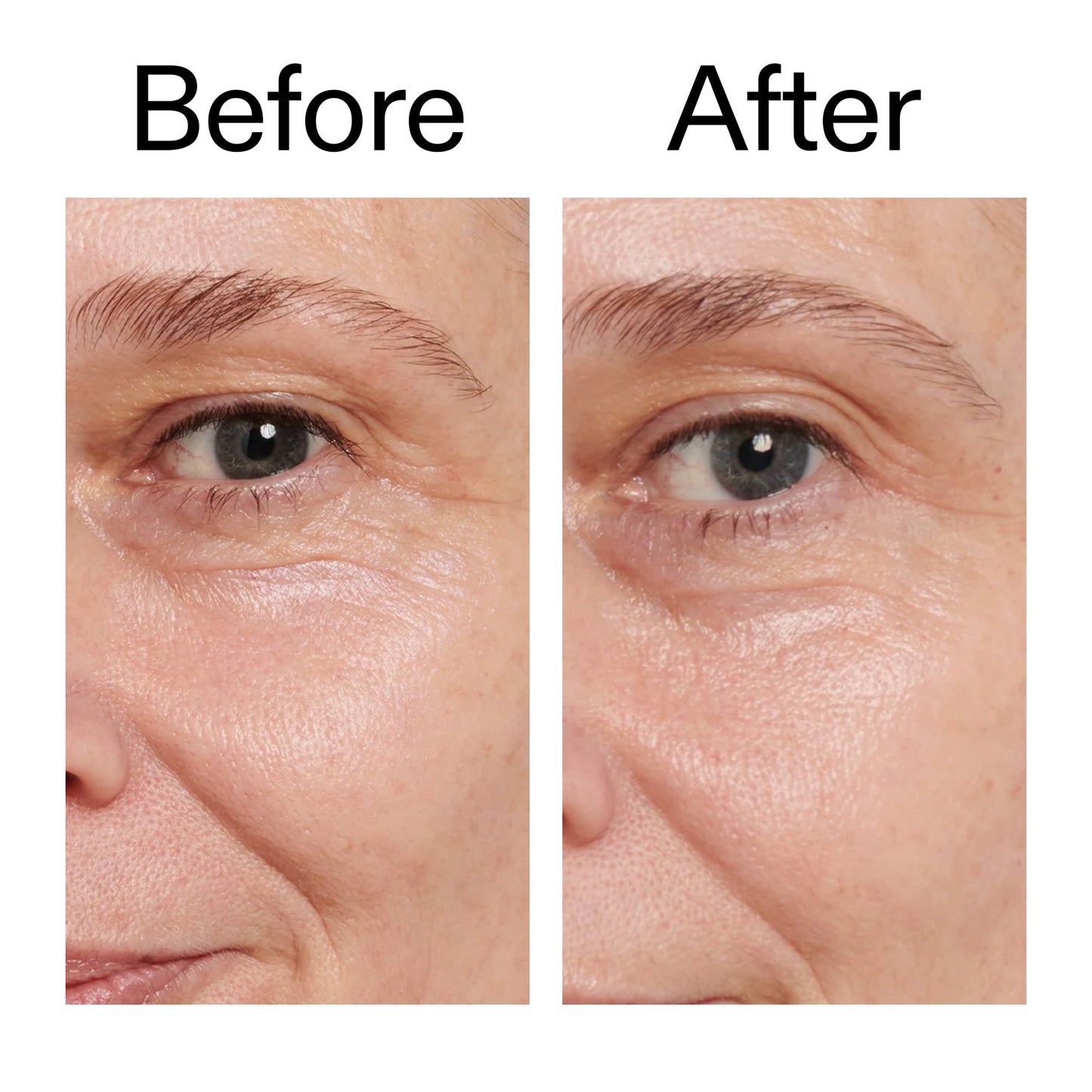 retinol-eye-cream-n5 Retinol_Eye_Cream_Before_After_2000x2000_ac03a80c-109e-4572-a95a-91dc109b4d27.jpg