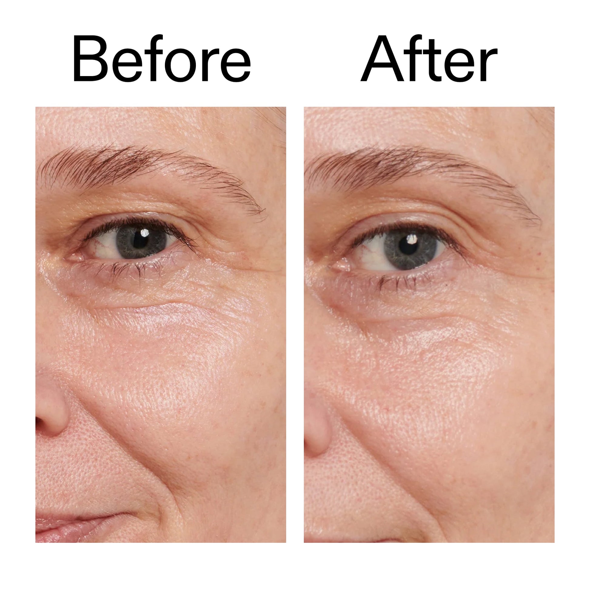 retinol-eye-cream-n5 Retinol_Eye_Cream_Before_After_2000x2000_ac03a80c-109e-4572-a95a-91dc109b4d27.jpg