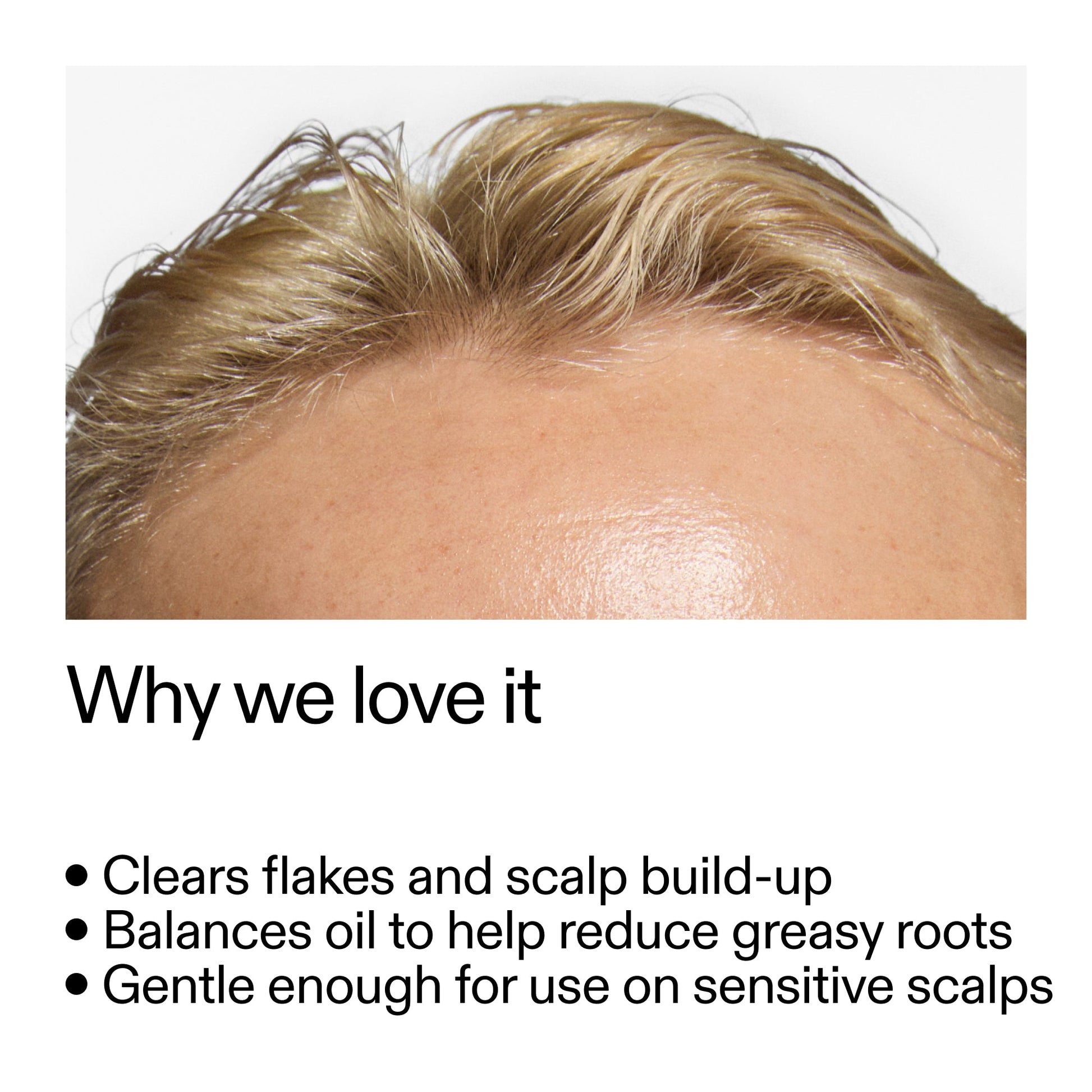 salicylic-acid-exfoliating-scalp-treatment-h2 Salicylic_Acid_Exfoliating_Scalp_Treatment_Why_we_love_it_2000x2000_44b6bd6d-9ec4-4b23-9dc4-bc3fd6f28e14.jpg