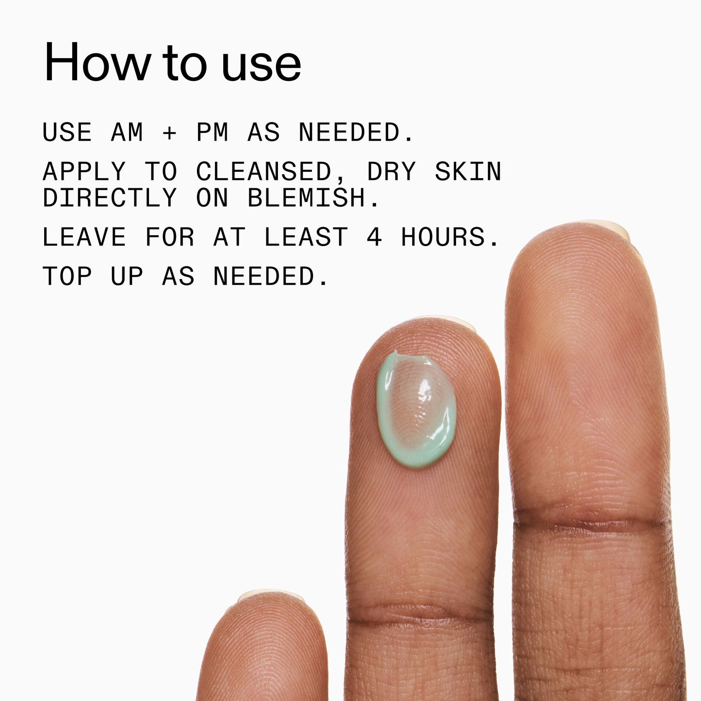 succinic-acid-acne-treatment-g2 Succinic_Acid_Treatment_How_to_Use_2000x2000_d57137d5-d7f1-427c-9a46-5fc00c19c542.jpg