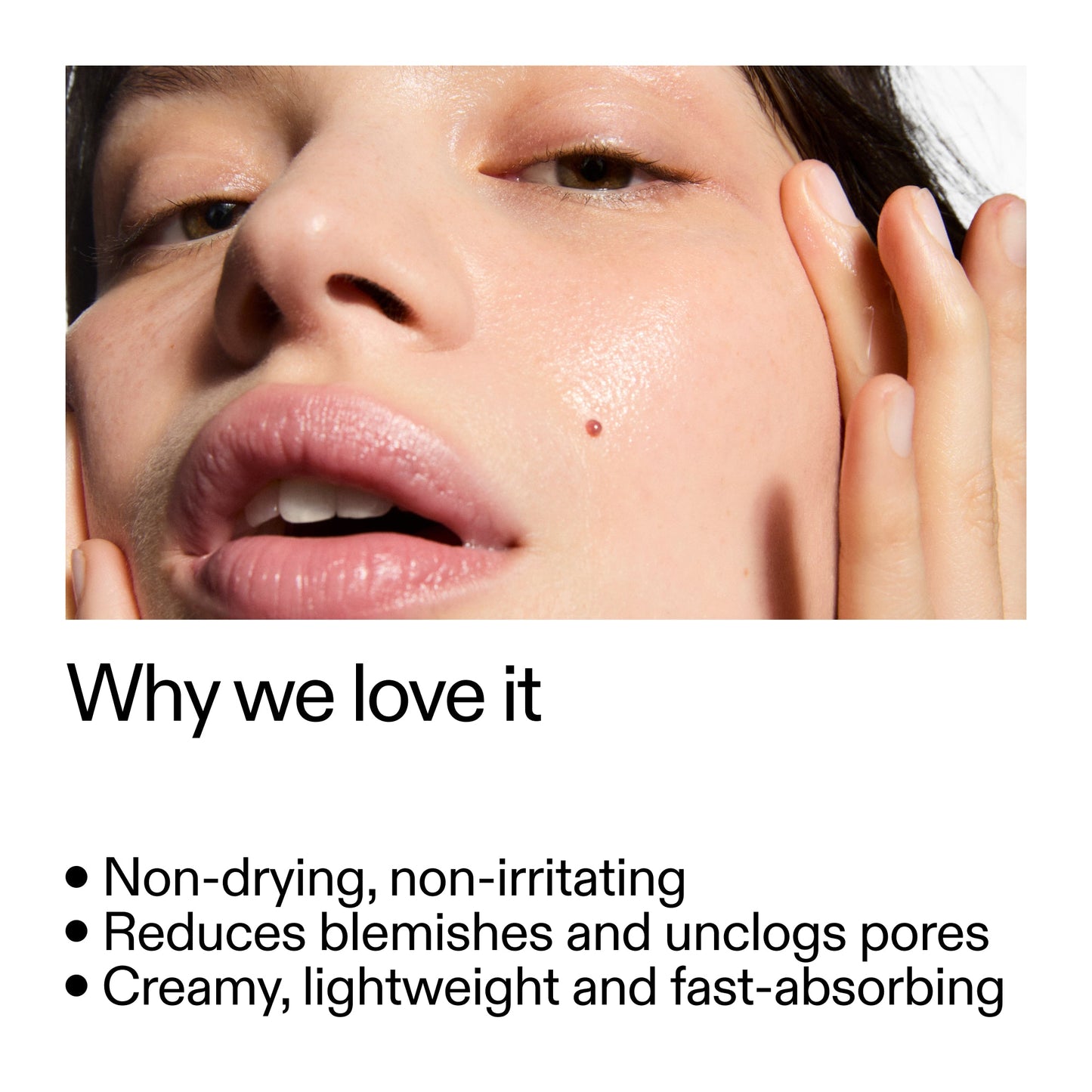 succinic-acid-acne-treatment-g2 Succinic_Acid_Treatment_Why_we_love_it_2000x2000_e90dd42a-cfe9-48b5-a2c7-d5eda787a6a8.jpg